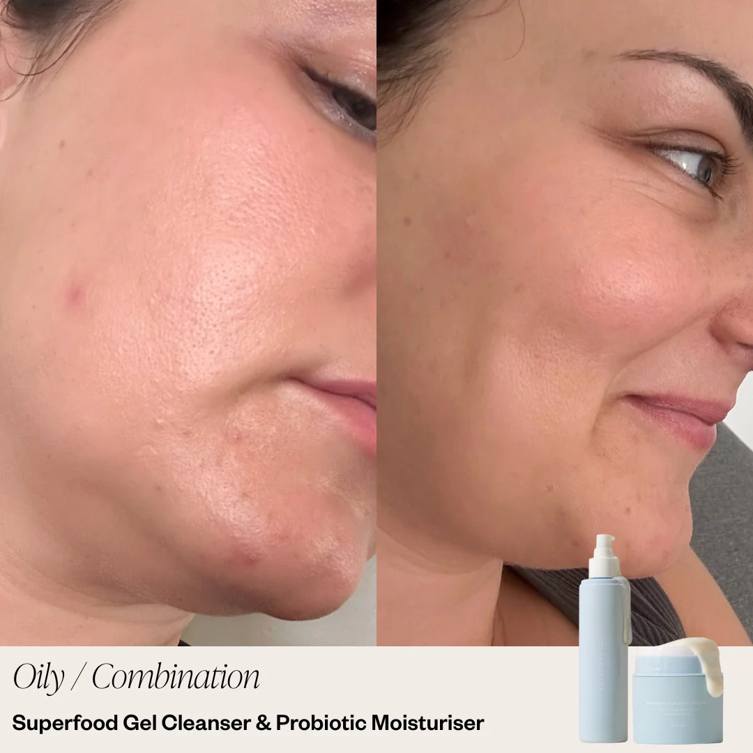 2 Step Skincare System - Image 3