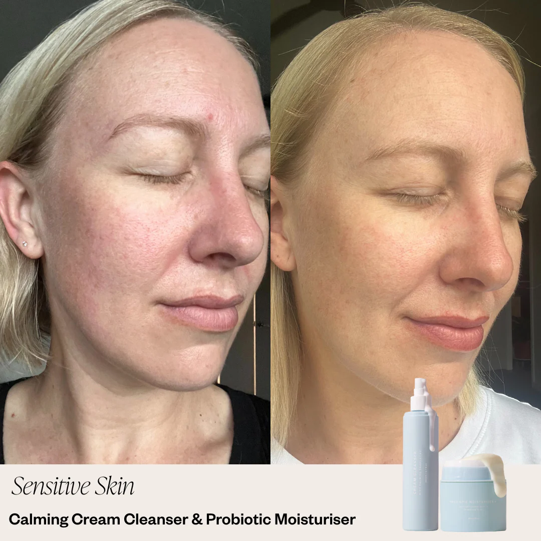 2 Step Skincare System - Image 5