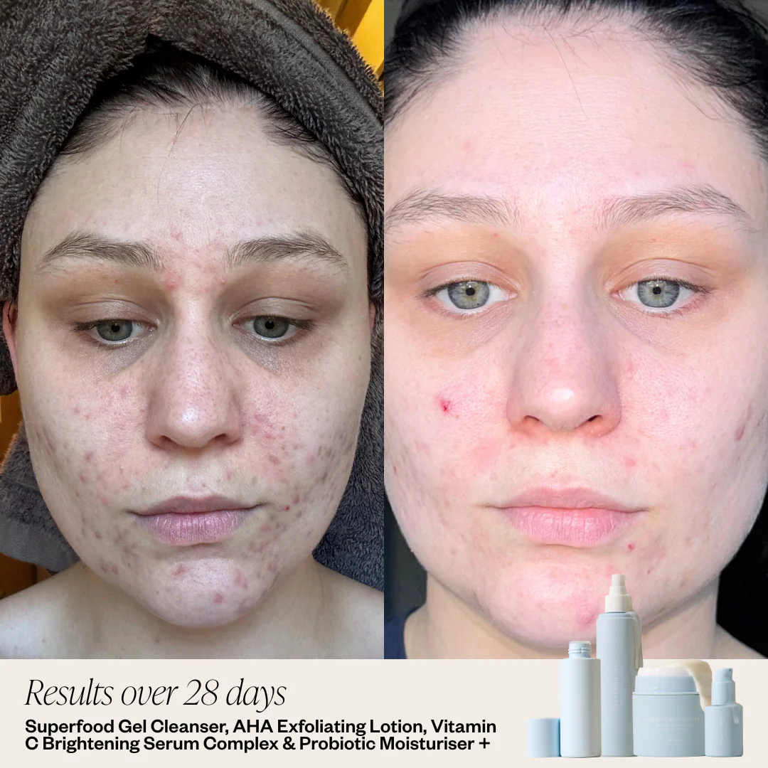 AHA Exfoliating Lotion - Image 4