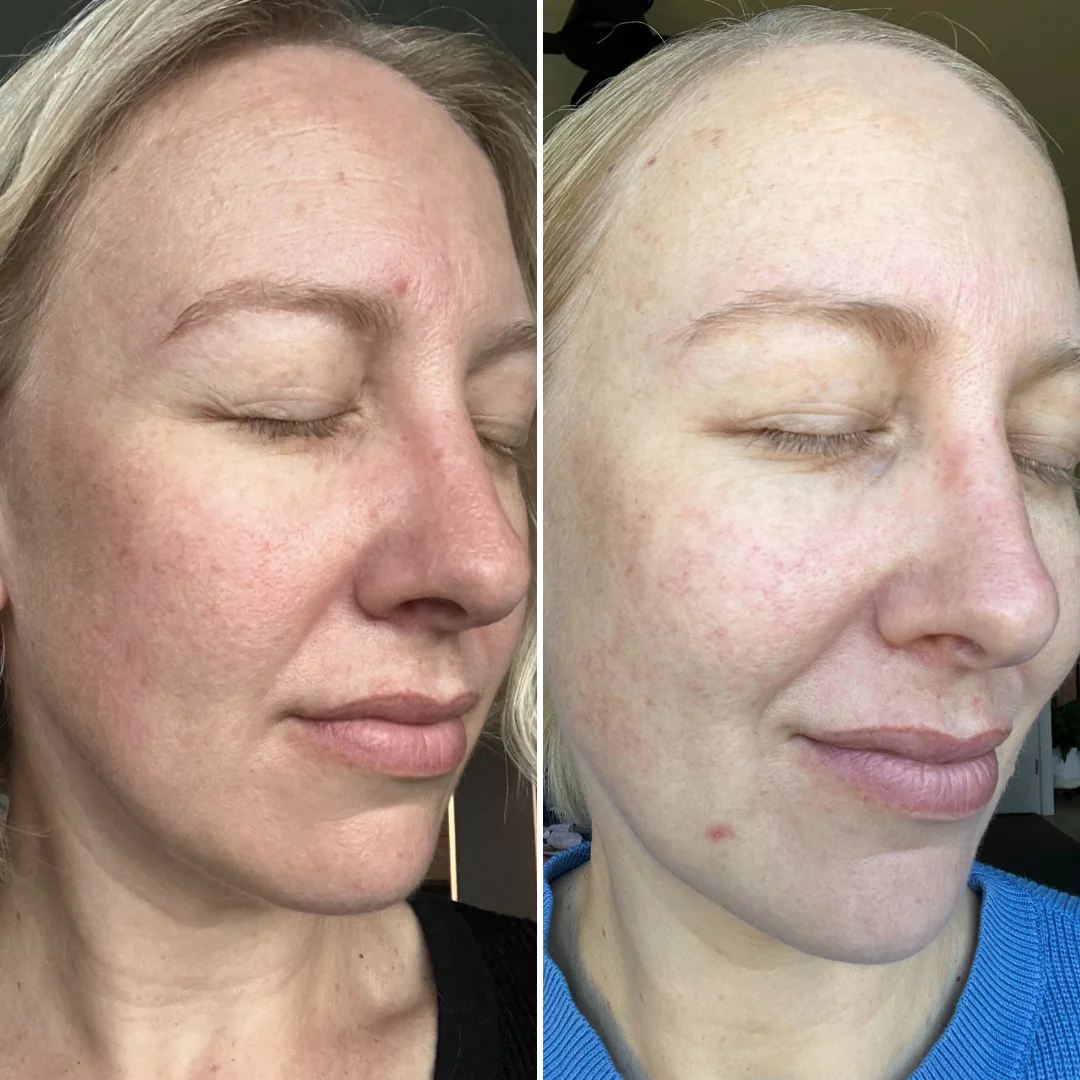 Firming Peptide Moisturiser - Trial Size - Image 10