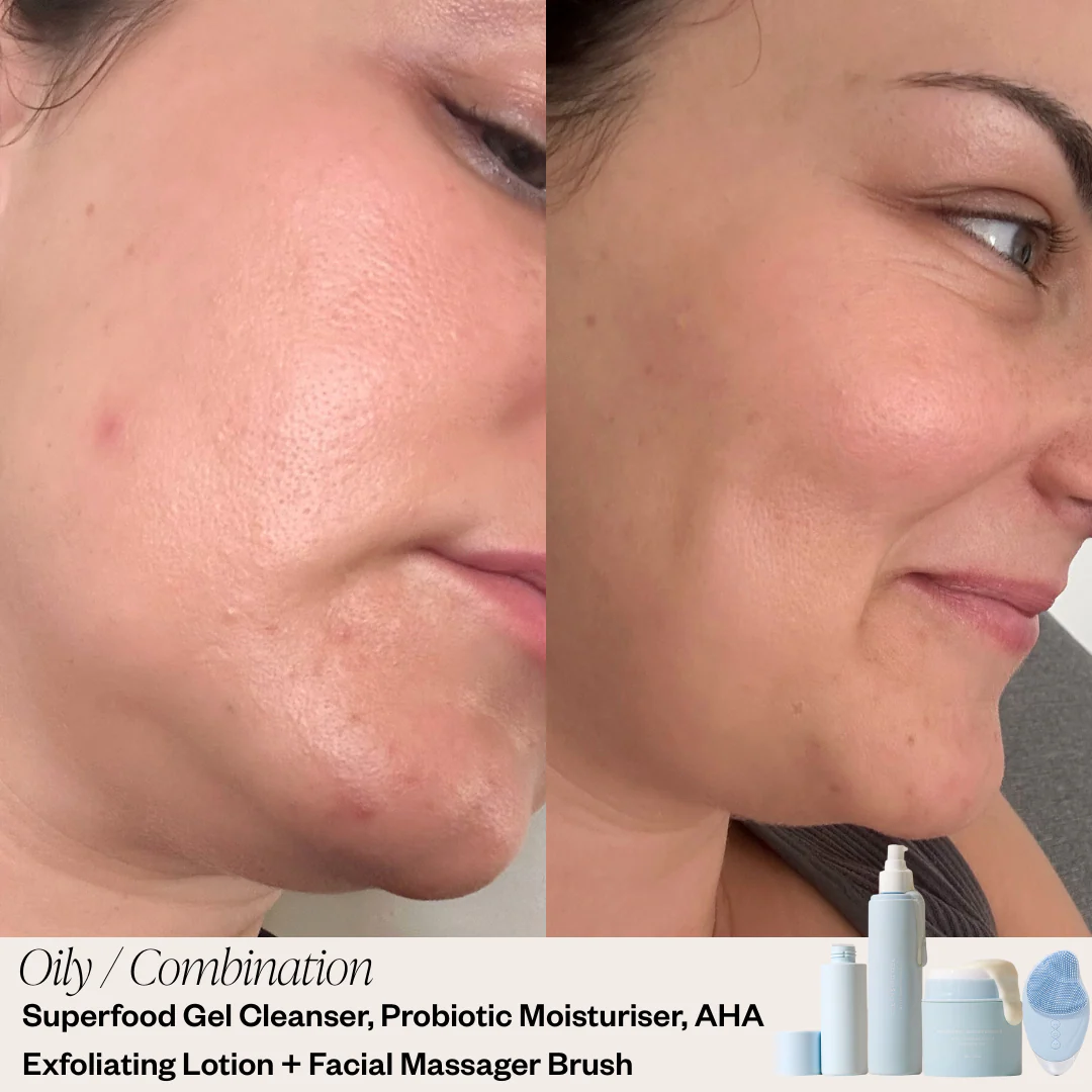 3 Step Skincare System - Image 3