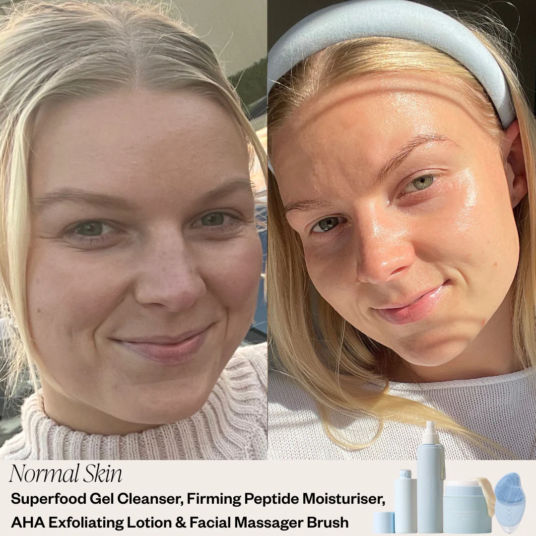 3 Step Skincare System - Image 5
