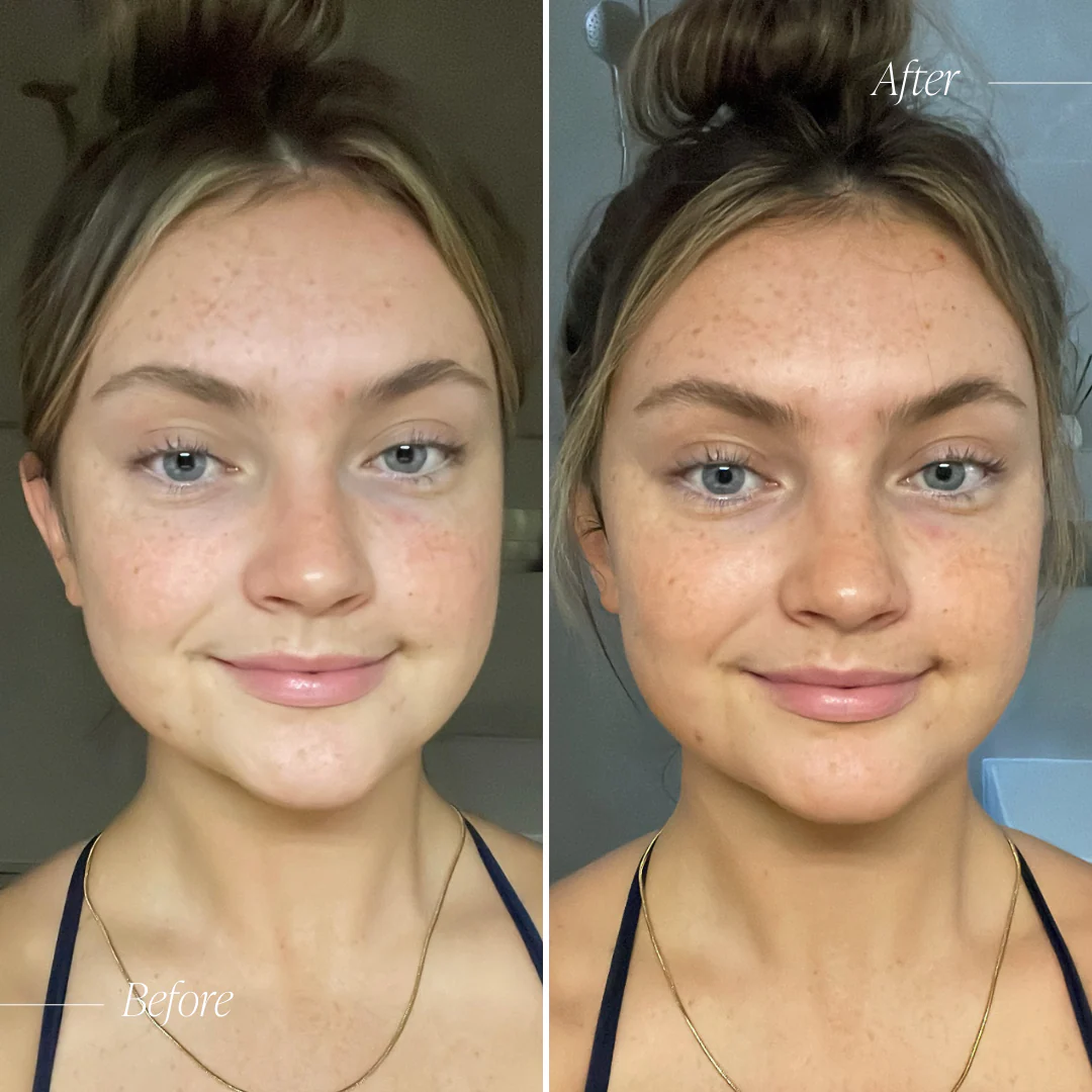 Guilt Free Glow Duo - Image 9