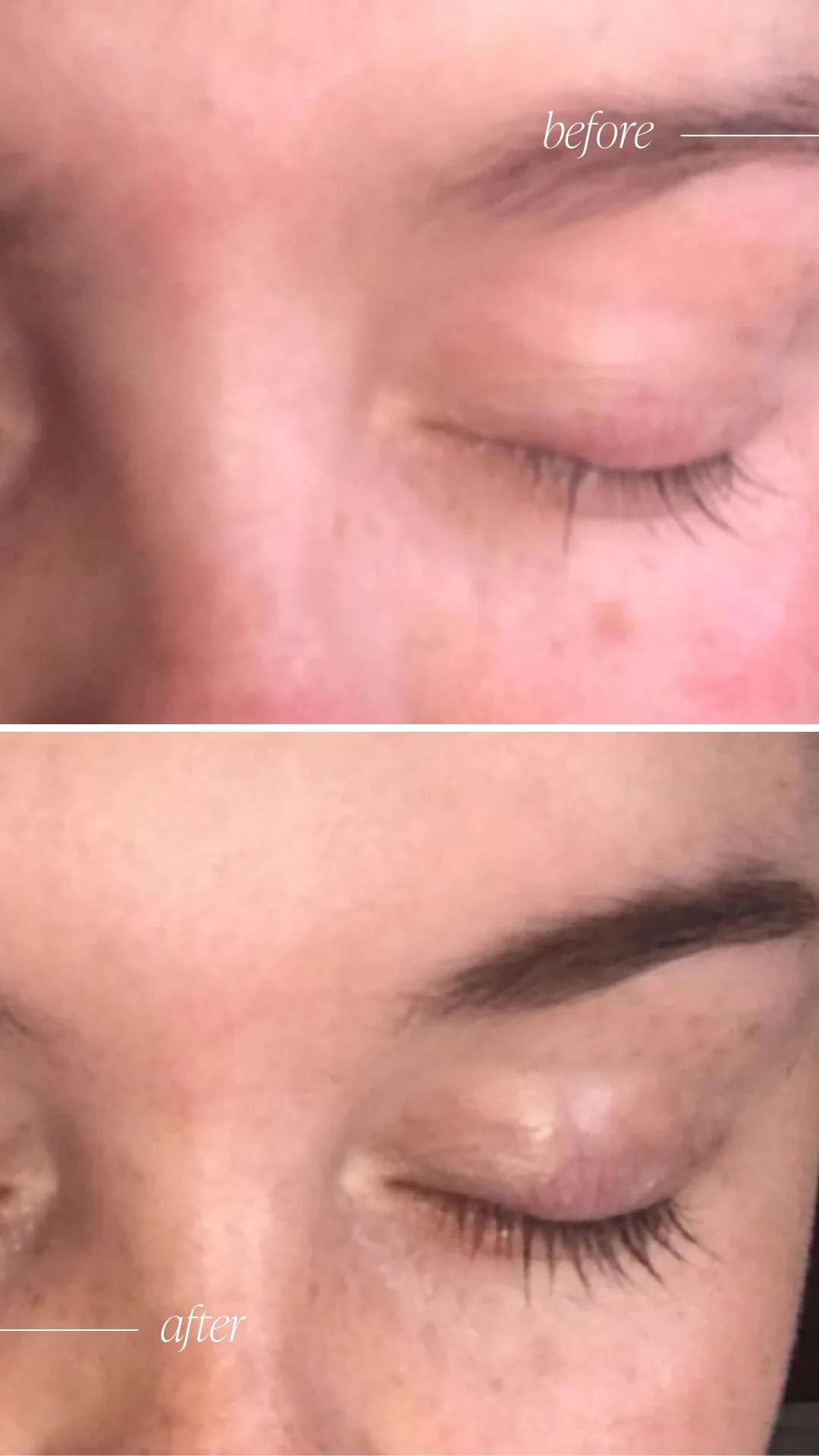 Lash & Brow Growth Serum - Image 3