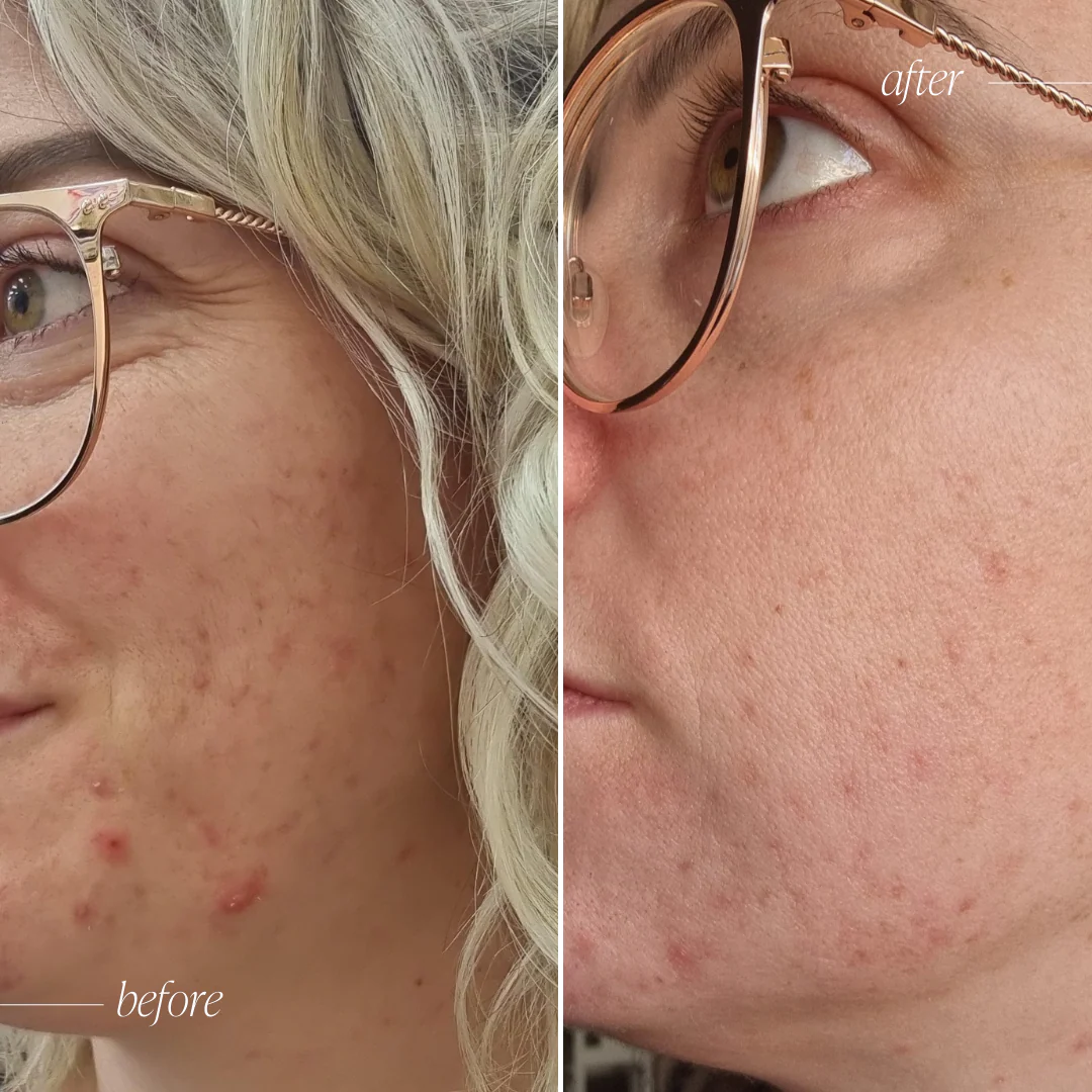 Probiotic Moisturiser + - Image 6
