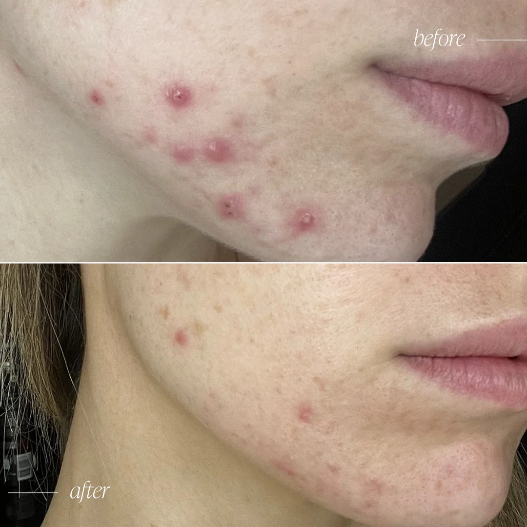 Probiotic Moisturiser + - Image 8