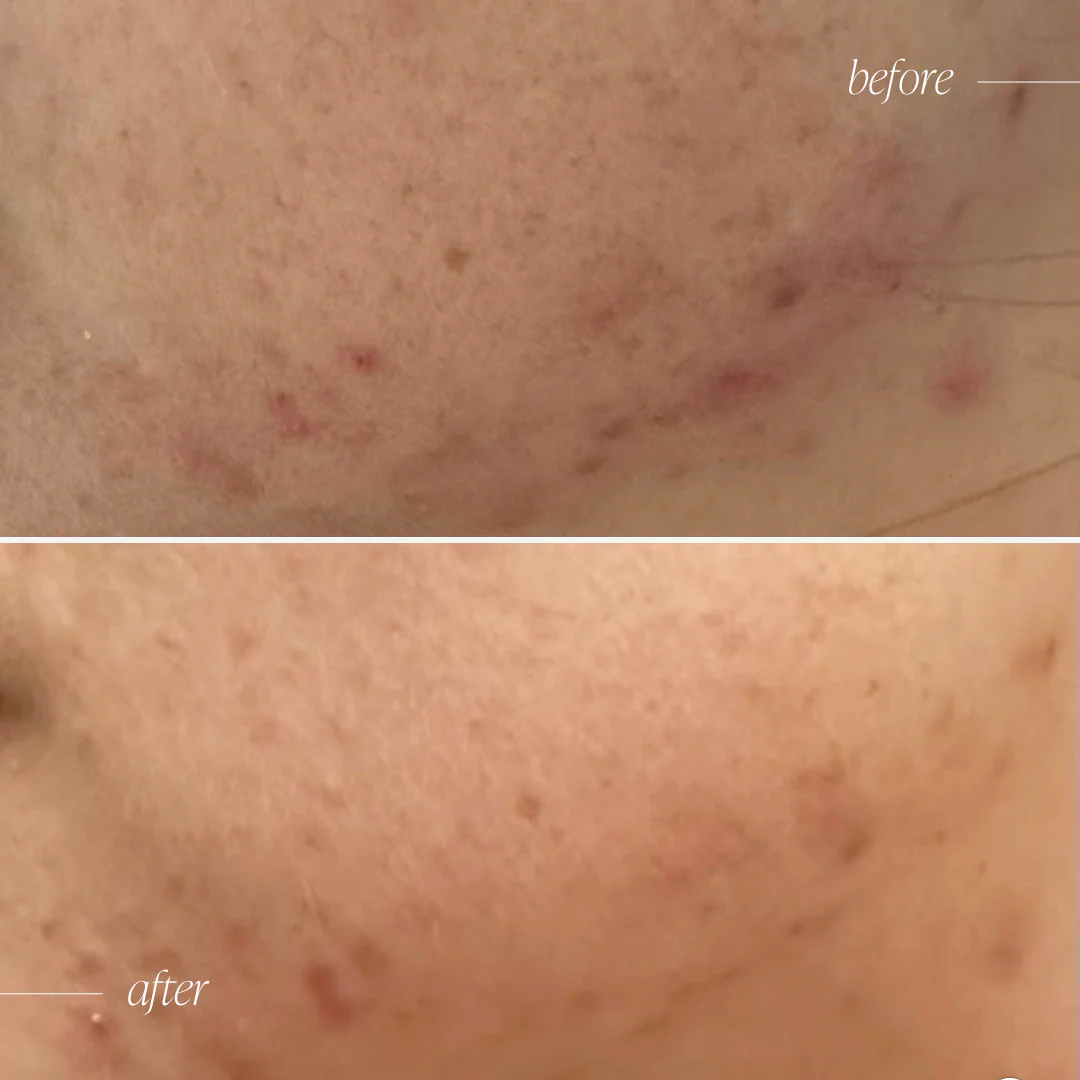 Probiotic Moisturiser + - Image 9