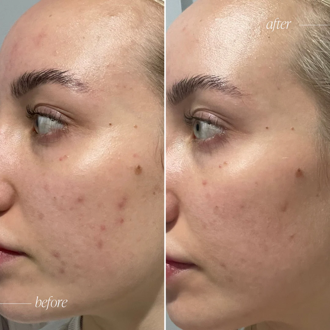 Probiotic Moisturiser + Trial Size - Image 3