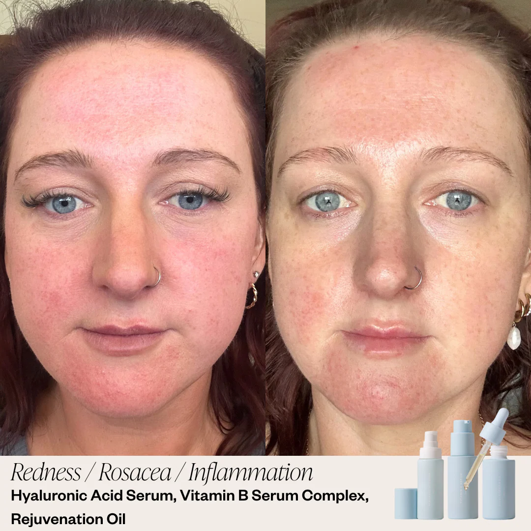 Targeted Serum System - Image 3