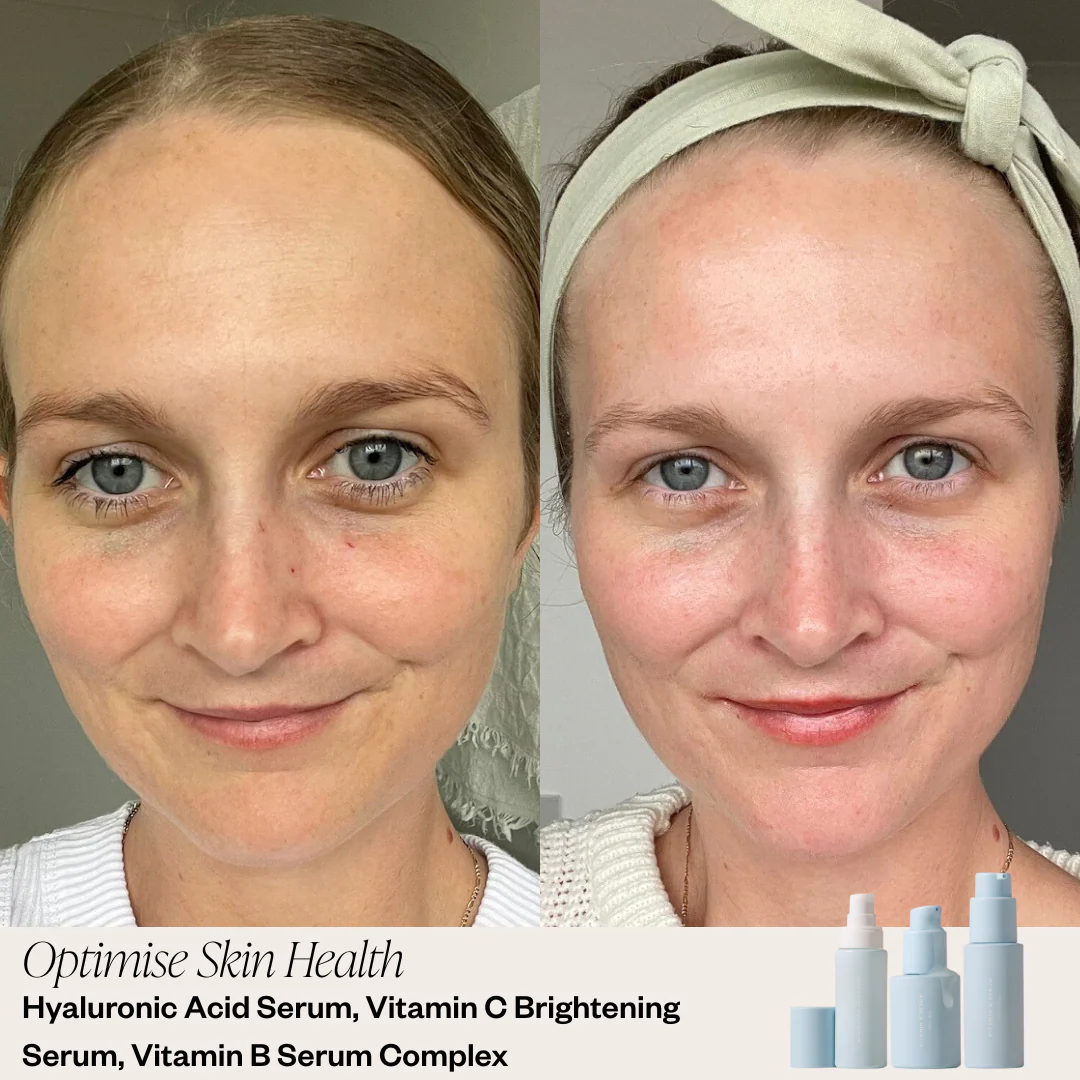 Targeted Serum System - Image 6