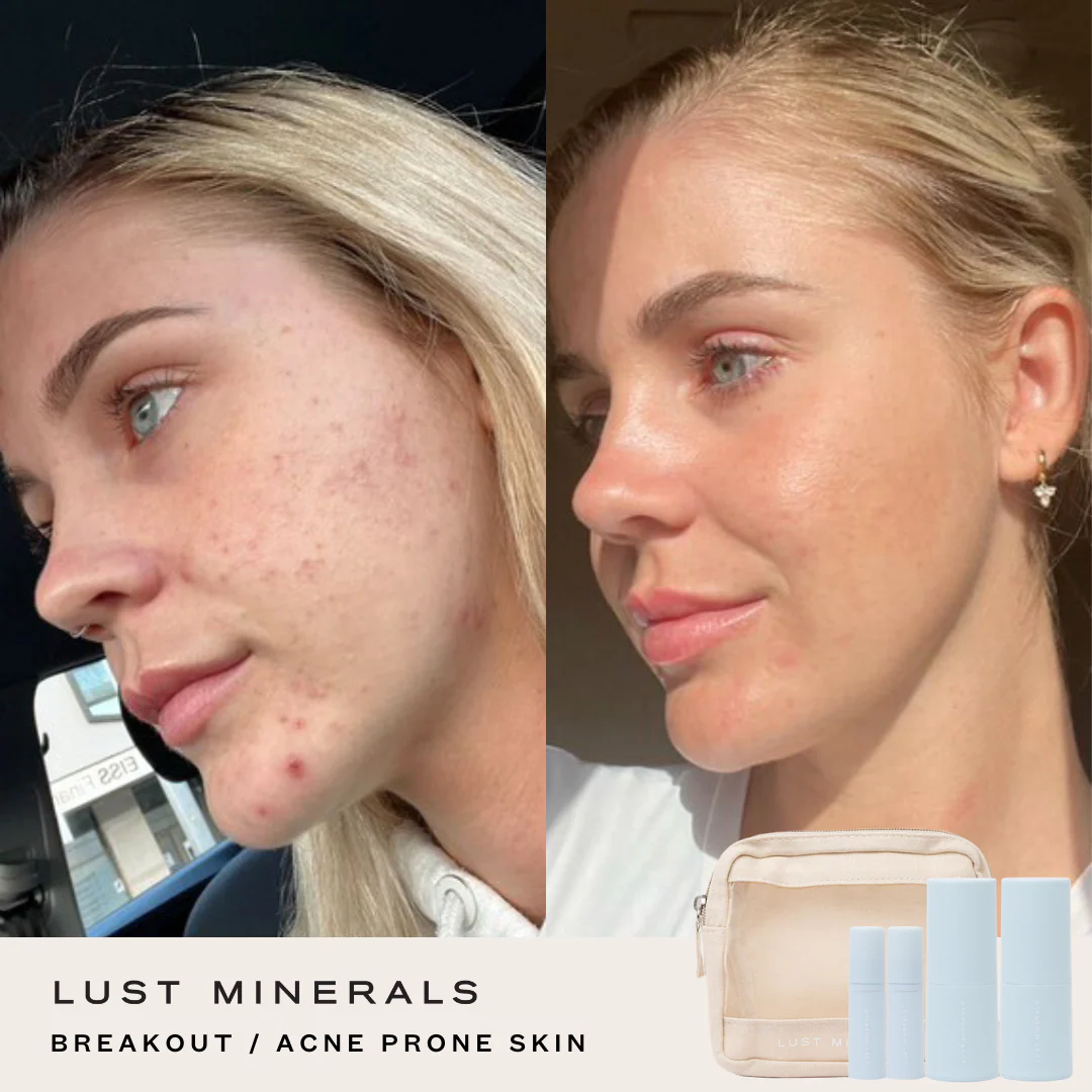 Targeted Skincare Trial System - Image 3