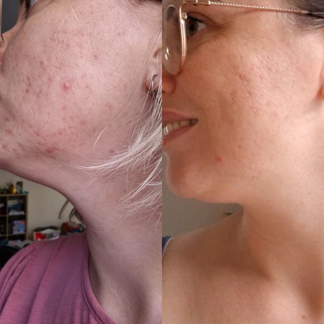 Targeted Skincare Trial System - Image 8