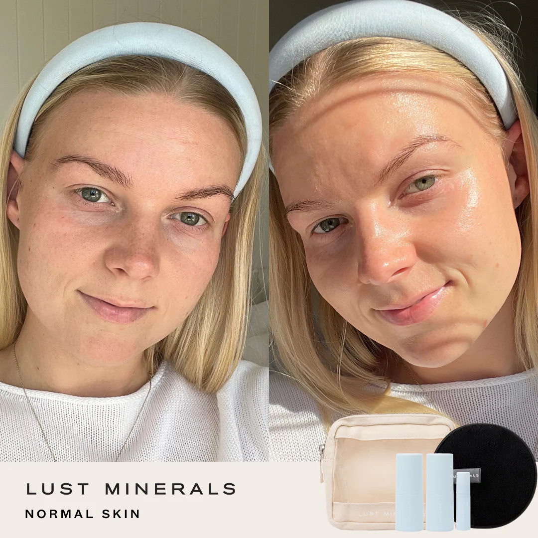 Teen Skincare Trial System - Image 3