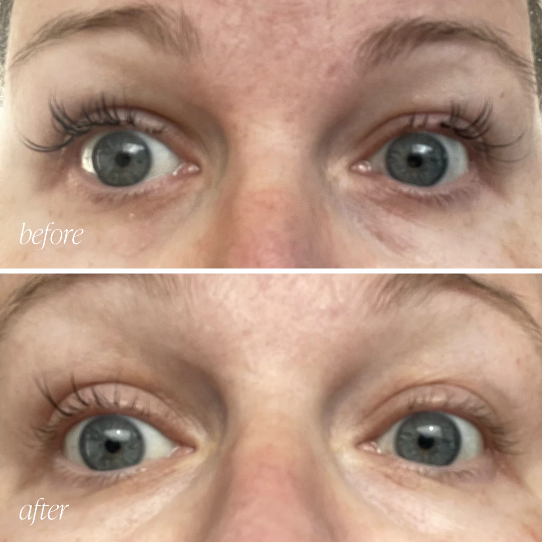 The Clean Skin Edit - Image 3