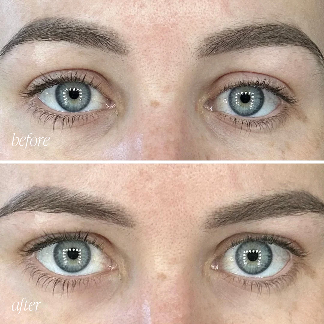 The Clean Skin Edit - Image 5