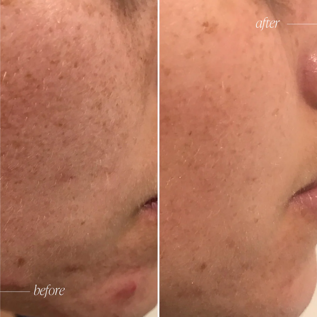 Vitamin C Brightening Serum - Trial Size - Image 3