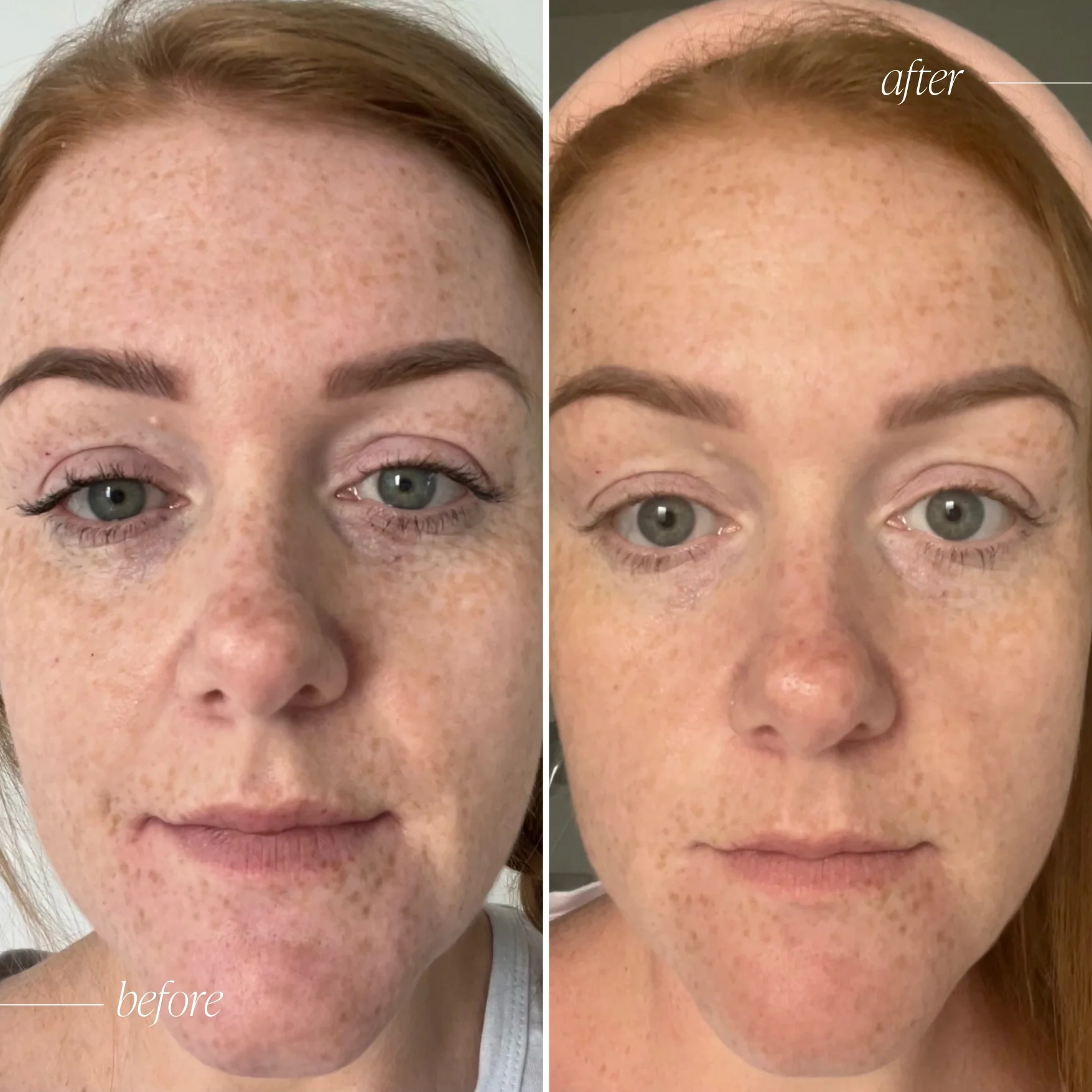 Vitamin C Brightening Serum - Trial Size - Image 5